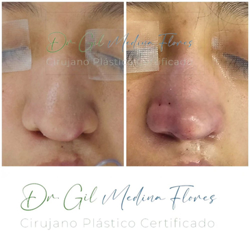 Slider image (6) Medina Flores Plastic Surgery